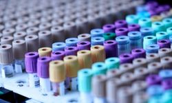 Japonya'da 1 kişide gizemli hepatit vakası saptandı