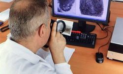 Abisinin Uykusunda boğazını ve cinsel organını kesmiş